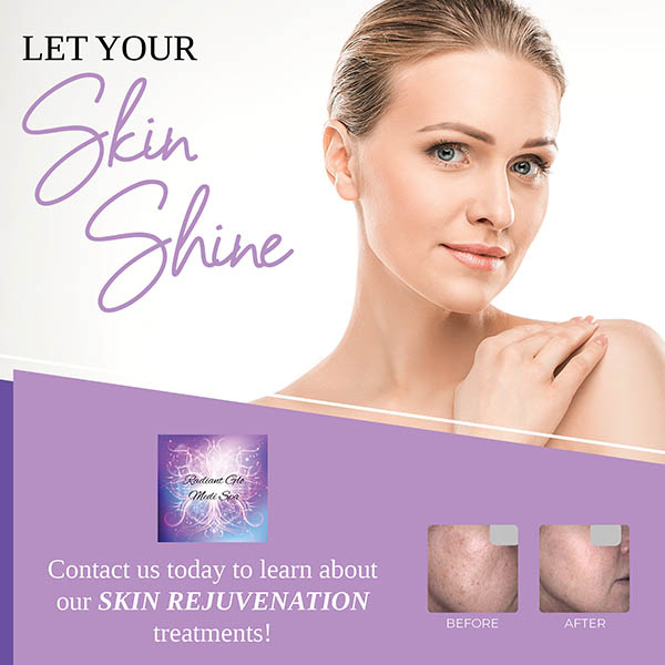 Radient-glo-skin-rejuvenation-scarborough