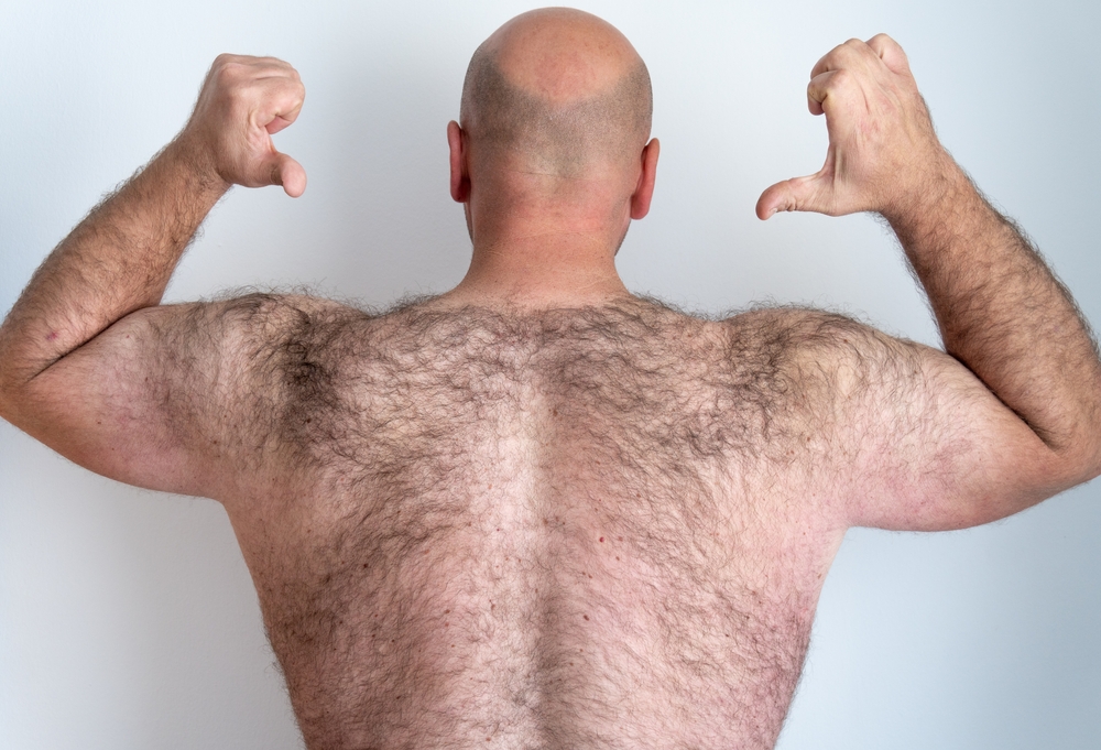 laser-hair-removal-scarborough,spa,